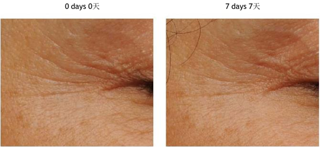 OEM ODM Moisturizing Anti-Aging Eye Mask Eye Patch